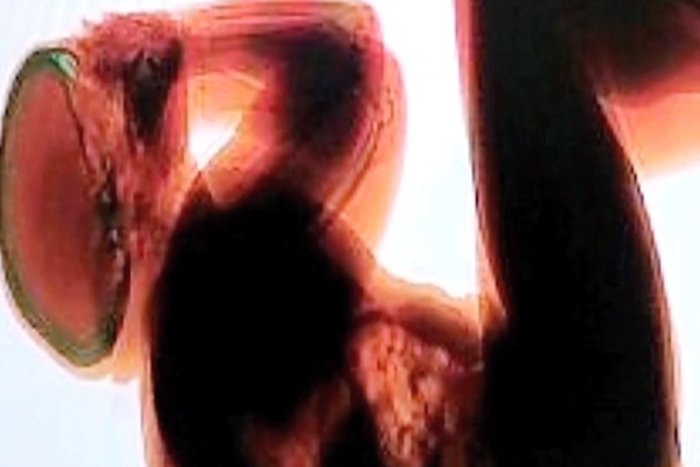 Больше ни капли: как заканчиваются суровые пьянки