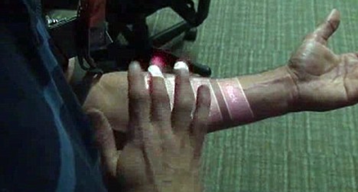 Система Skinput превратит руку в  сенсорный экран