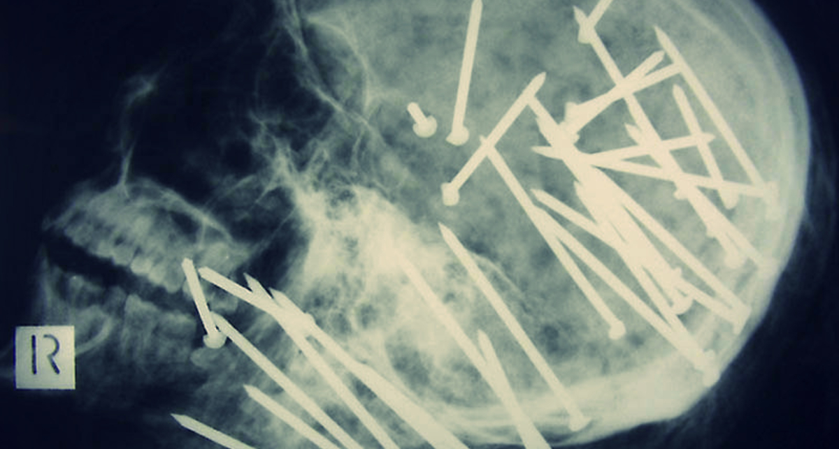 Ольга Богомолец: начать реформу здравоохранения нужно с АПК