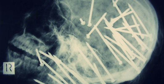 Ольга Богомолец: начать реформу здравоохранения нужно с АПК