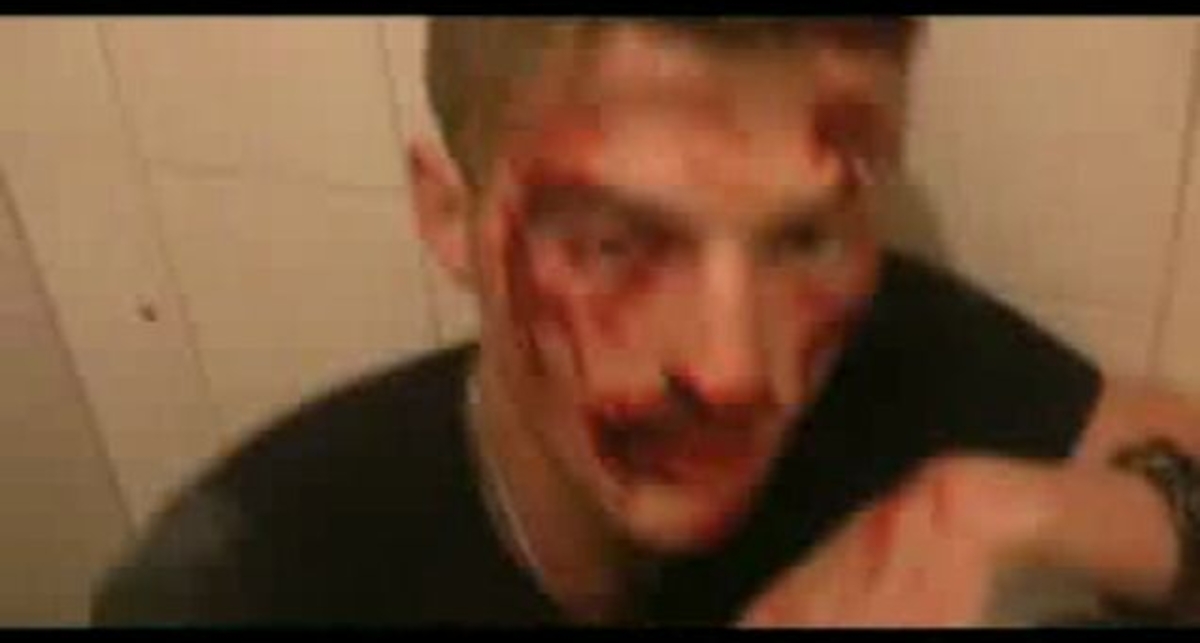 Павла Волю жестоко избили!