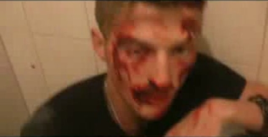 Павла Волю жестоко избили!