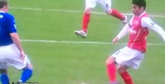 перелом ноги на футболі