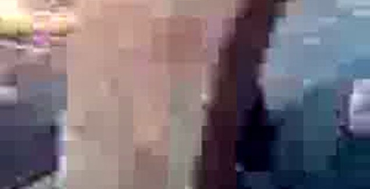 удар палкой в голову