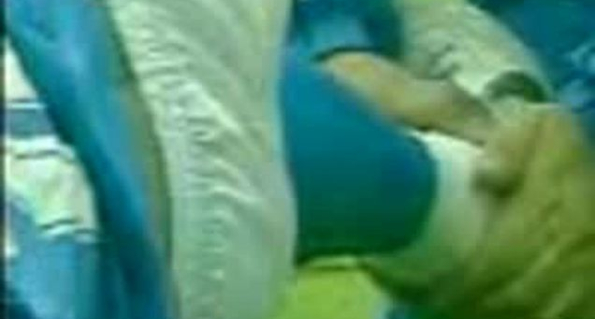 зламав ногу