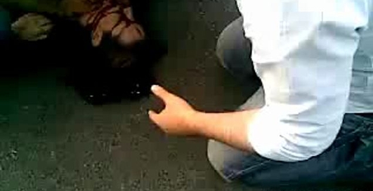 Девушку сбила машина, и она получила внутренней кровотечение