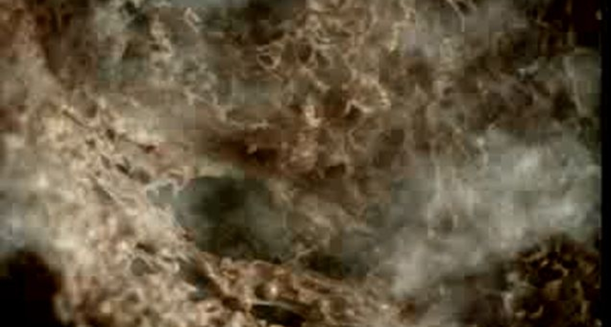 Вред курения - кислота для лёгких