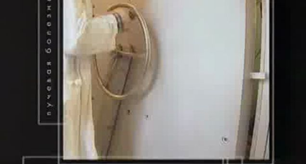 Лучевая болезнь