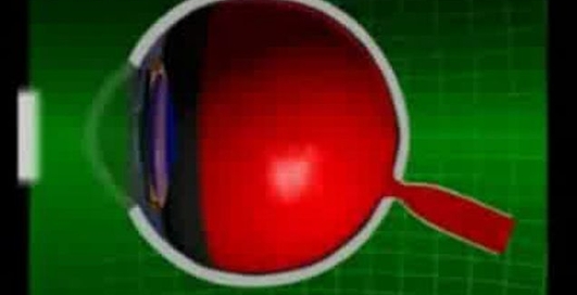 Чудо в клетке