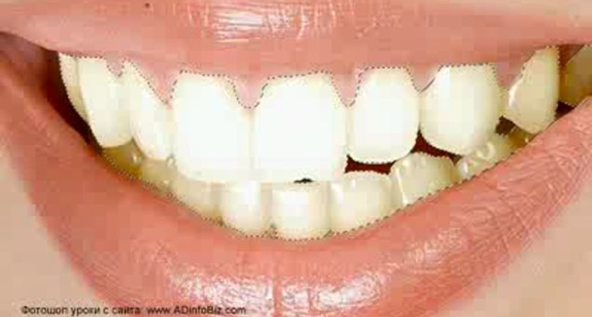 Фотошоп Как сделать белые зубы в фотошопе