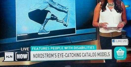 Алекс Мински: солдат стал моделью после ампутации