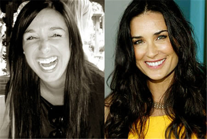 Хочу быть похожим на звезду: десять историй с пластическими операциями