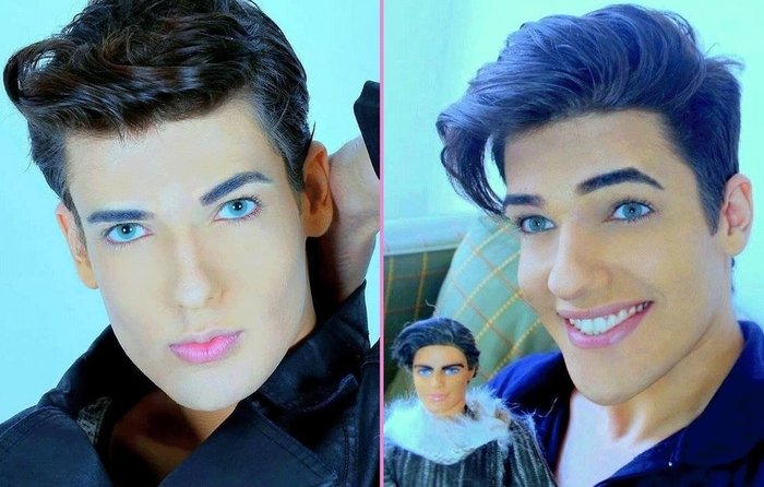 Хочу быть похожим на звезду: десять историй с пластическими операциями