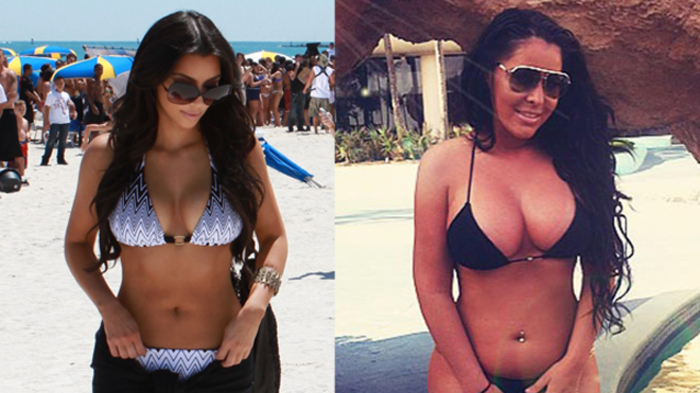 Хочу быть похожим на звезду: десять историй с пластическими операциями