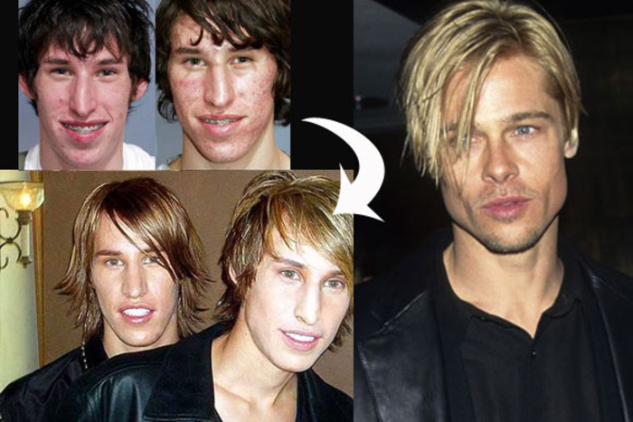 Хочу быть похожим на звезду: десять историй с пластическими операциями