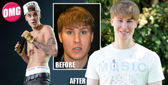 Хочу быть похожим на звезду: десять историй с пластическими операциями