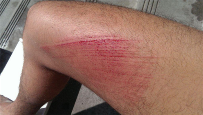 Почему не быть олимпийским дайвером — это прекрасно