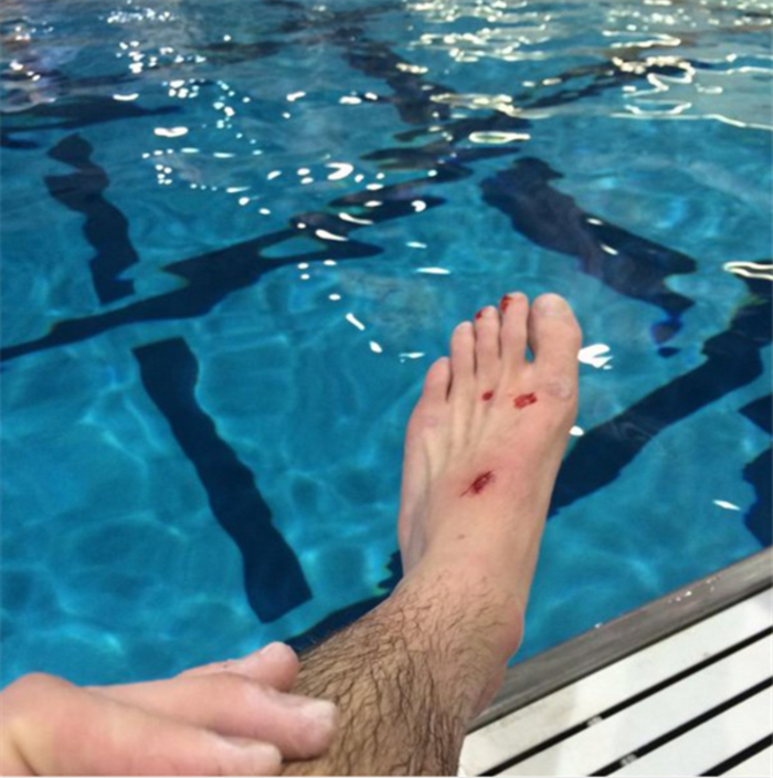 Почему не быть олимпийским дайвером — это прекрасно