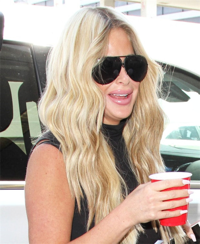 Звезды, испоганившие свои губы &quot;пластикой&quot;