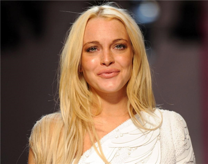 Звезды, испоганившие свои губы &quot;пластикой&quot;