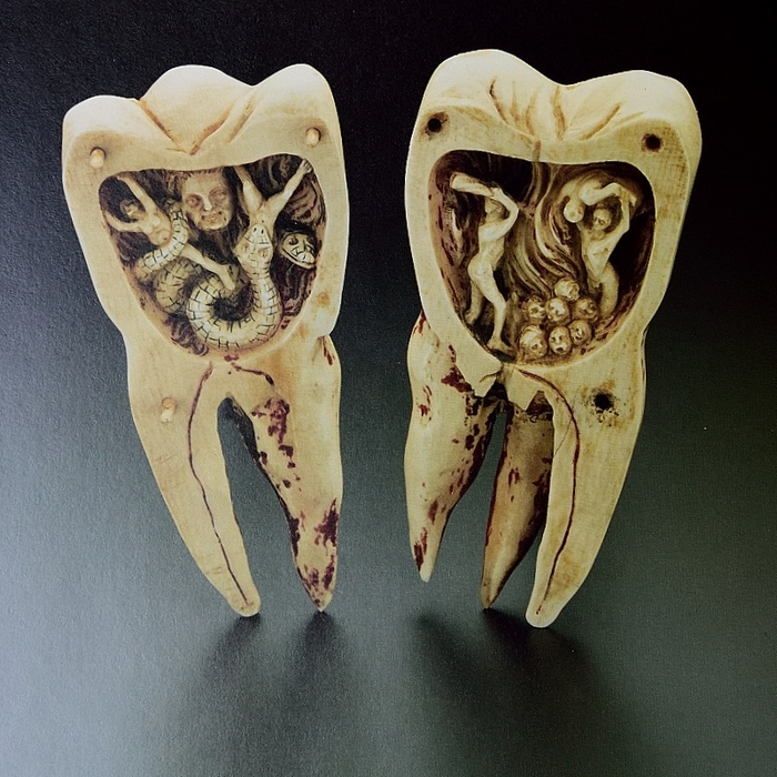 Самые жуткие зубные протезы в истории человечества
