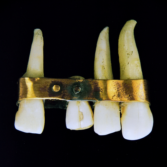 Найстрашніші зубні протези в історії людства