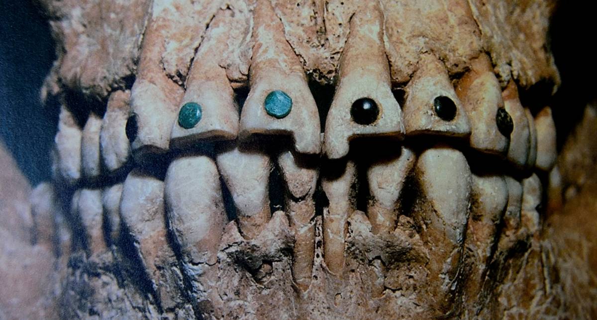 Самые жуткие зубные протезы в истории человечества