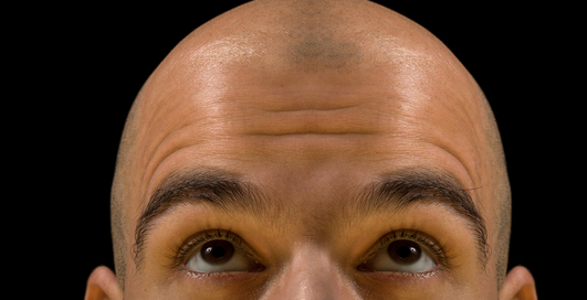 Шевелюра на вырост