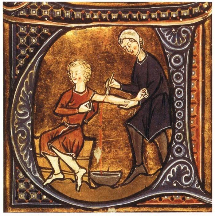 Жуткая медицина: как лечили в Средневековье