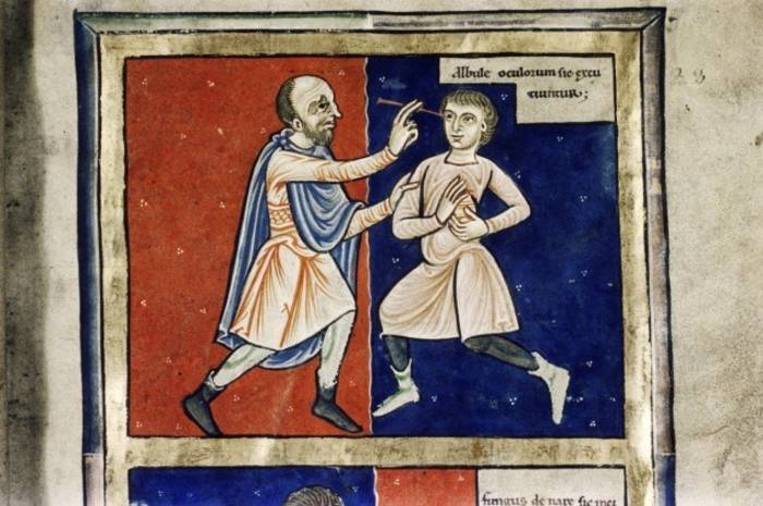 Жуткая медицина: как лечили в Средневековье